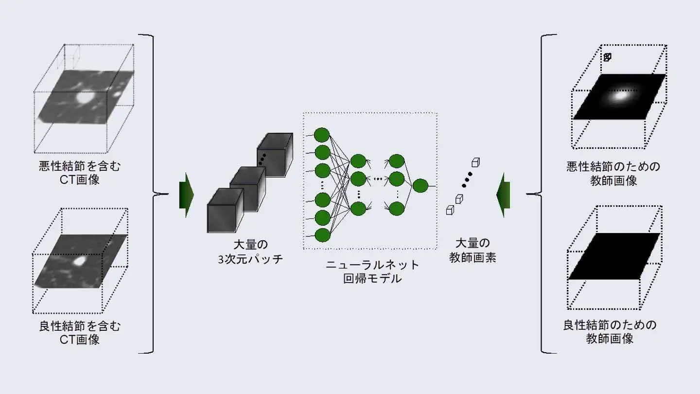 超軽量深層学習により少数症例で肺がん診断支援AIを開発 | Science