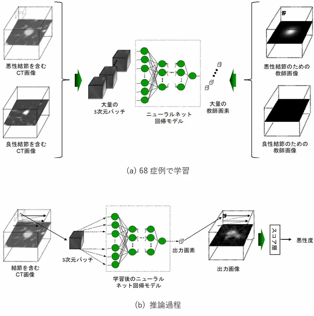 超軽量深層学習により少数症例で肺がん診断支援AIを開発～GPUサーバ無しで学習、ラップトップで推論できるエッジAI～