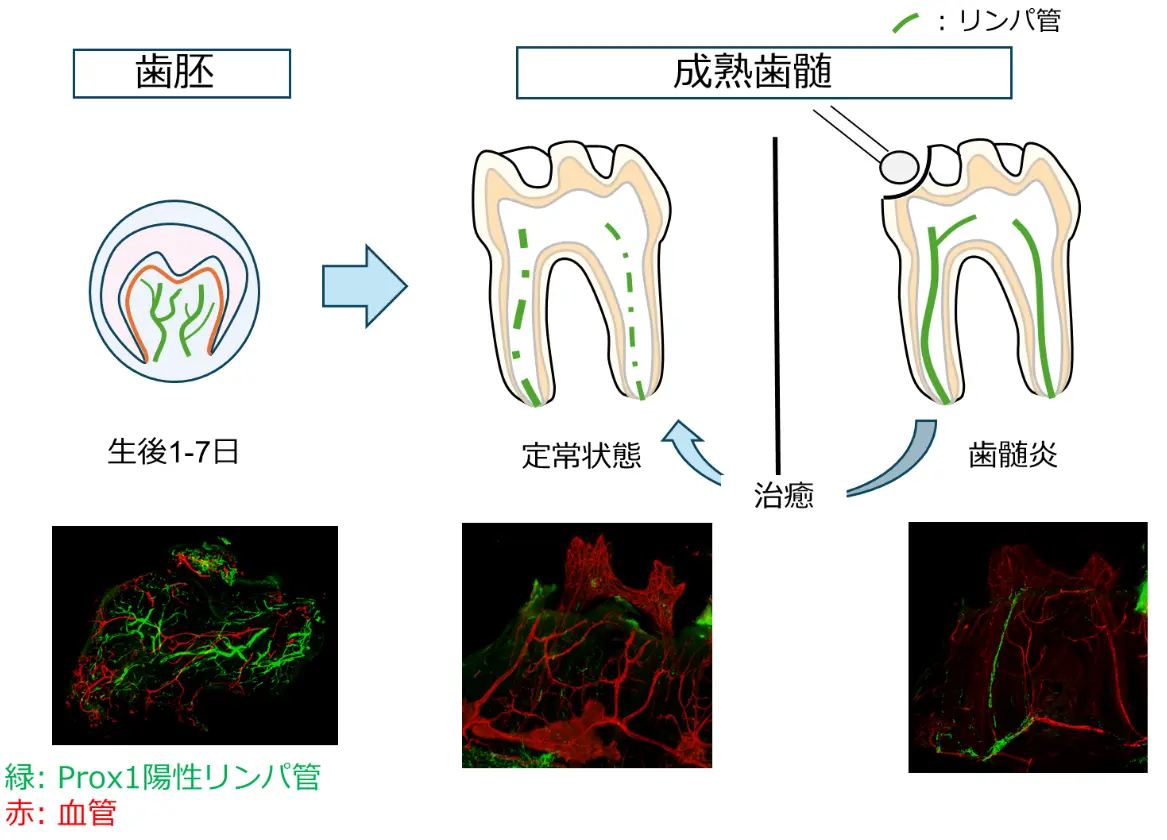 歯髄リンパ管の立体構造を世界で初めて可視化～歯の中に存在するリンパ管ネットワークとその動態を解明～