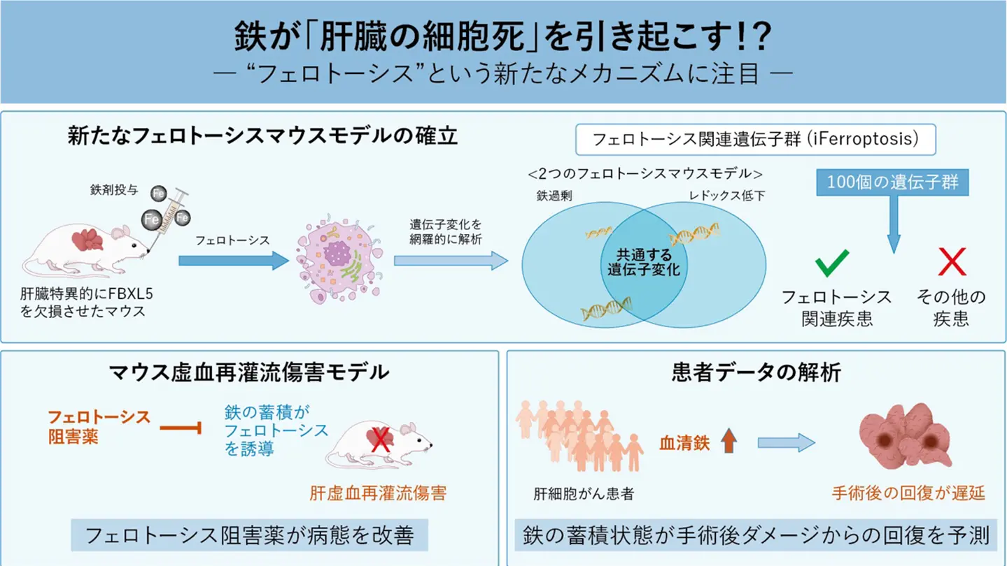 鉄が肝臓を傷つける—新たな細胞死フェロトーシスの正体とは～手術後の回復を左右する鉄と100の遺伝子を発見、肝疾患の診断と治療に新たな可能性～