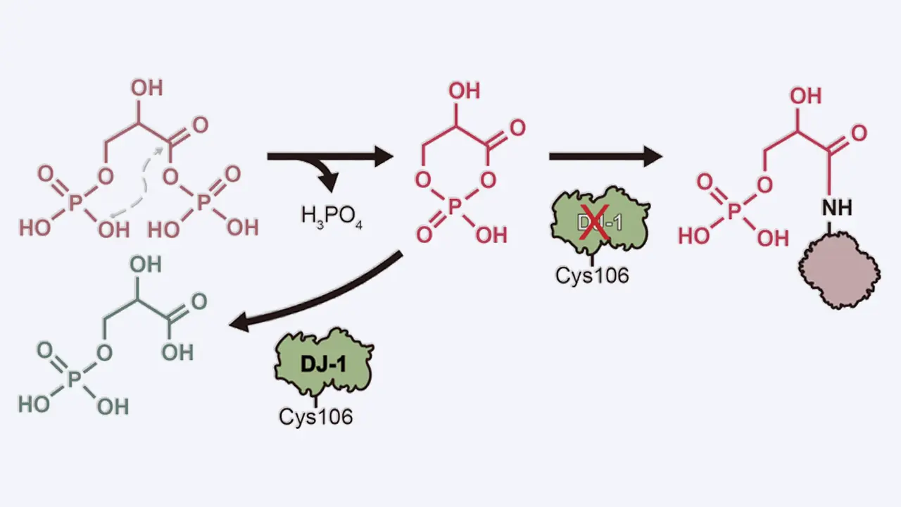 内在性の“毒”の分解がパーキンソン病の発症を抑える | Science Tokyo