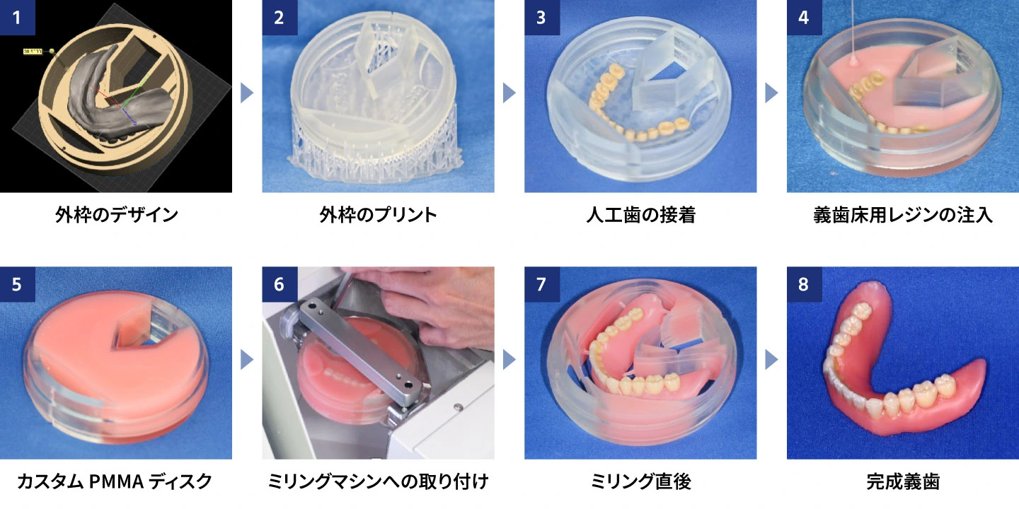 超高齢社会における歯科医療の課題をデジタル化で解決—金澤学
