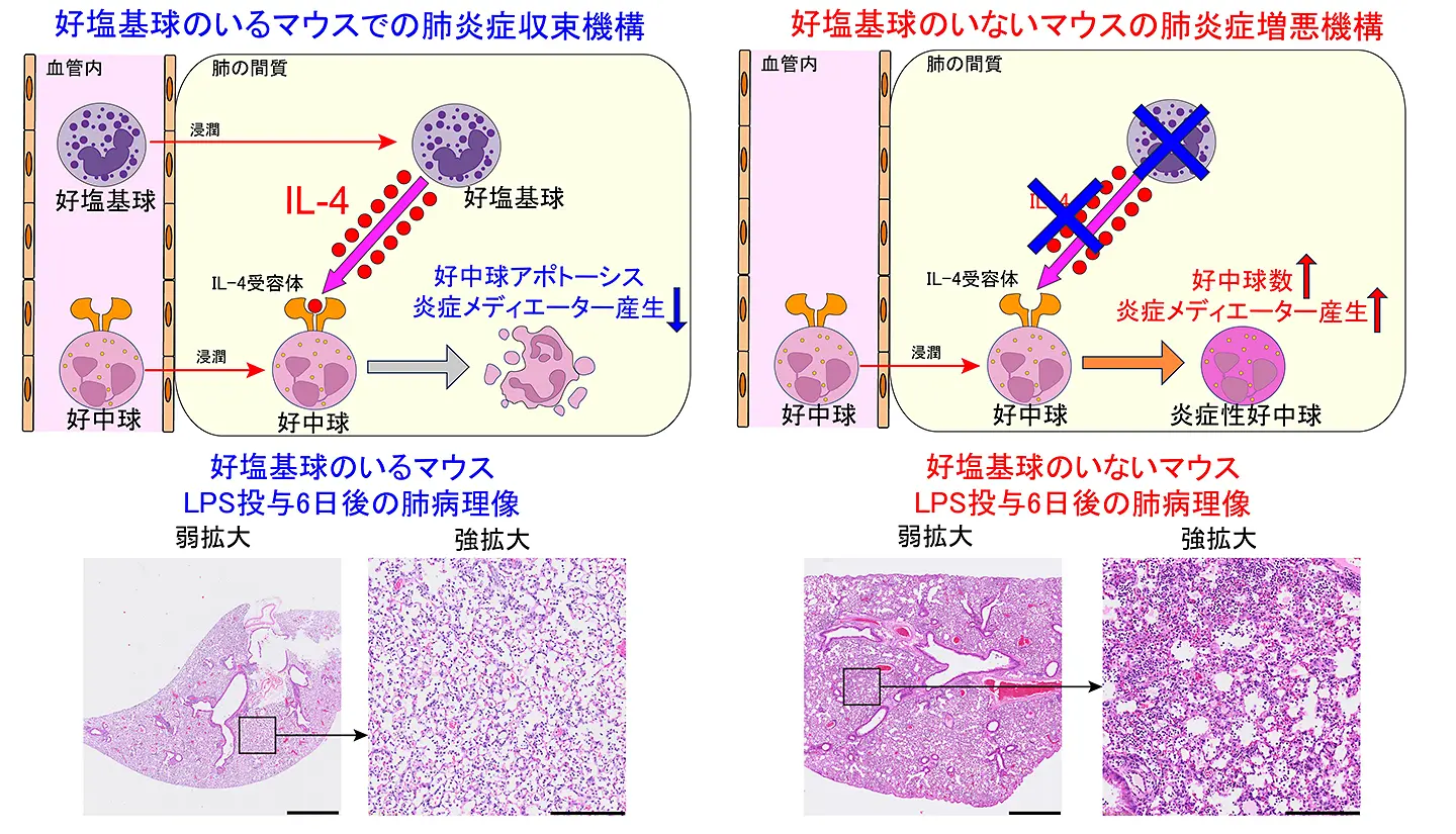希少免疫細胞が命を救う―ARDS回復の鍵は好塩基球～“アレルギーの悪玉”が肺の炎症を抑える善玉に、新たな治療法開発に期待～