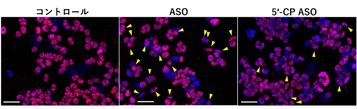 神経疾患治療用アンチセンス核酸医薬の安全性を高める新技術を開発