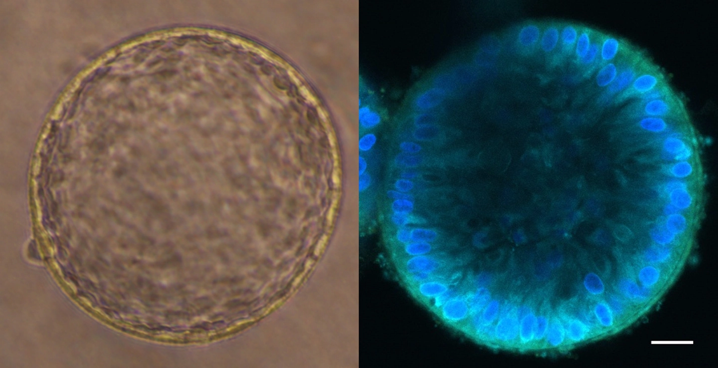 ヒト腎臓オルガノイドで慢性腎臓病の老化・線維化過程を再現～患者由来細胞から構築した三次元モデルが創薬プラットフォームに～