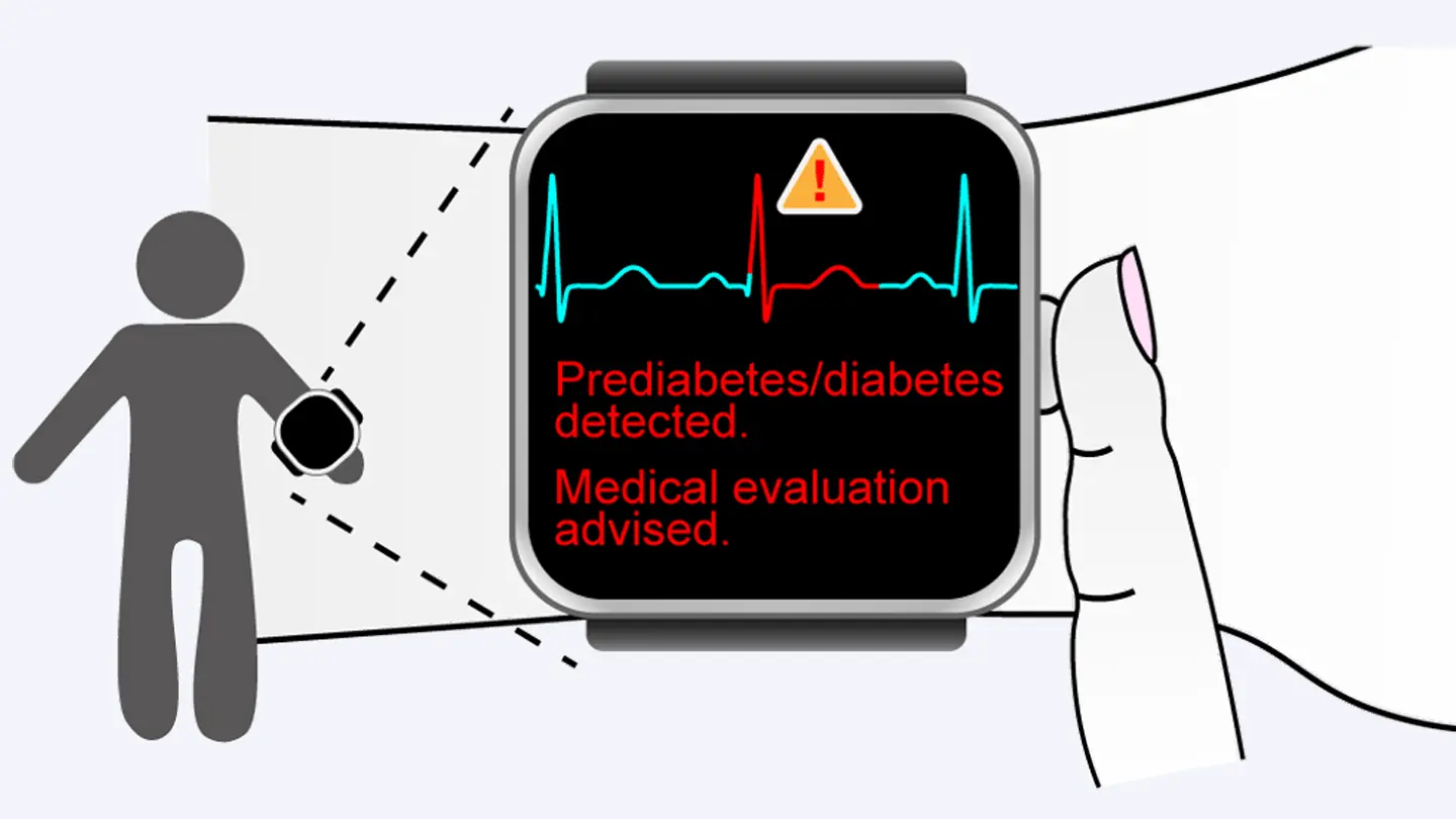 心電図の測定だけで糖尿病予備群を発見 | Science Tokyo - 東京科学大学