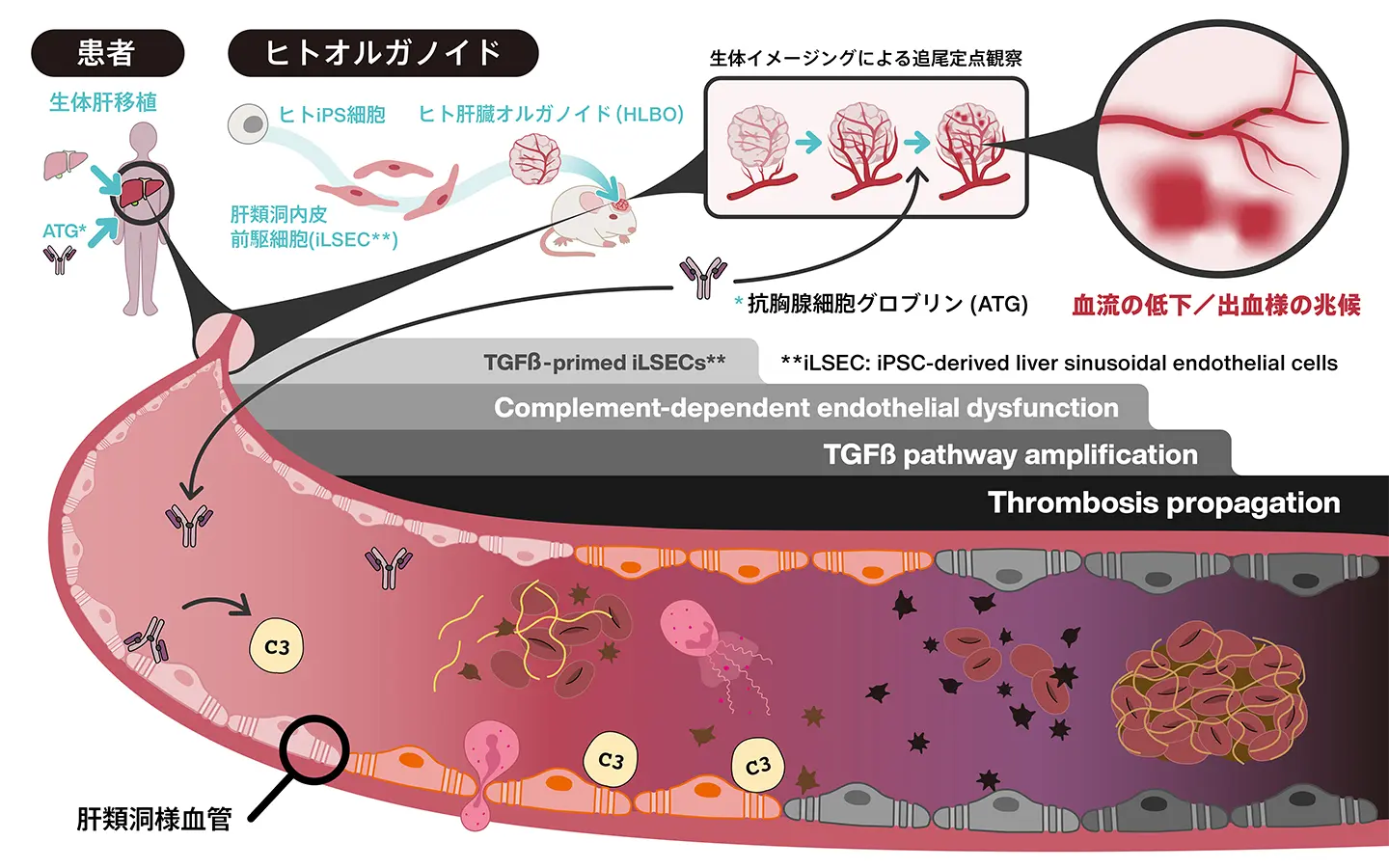 ヒトiPS細胞由来血管化肝臓オルガノイドで免疫抑制薬による血管障害の仕組みを解明～移植医療で使用される薬剤が引き起こす肝臓微小血管障害を世界で初めて可視化～