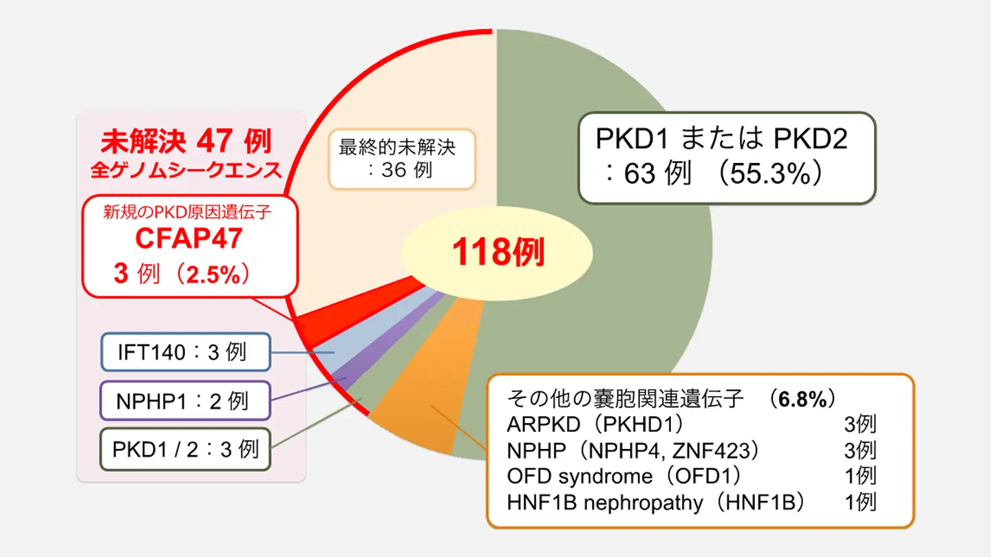 指定難病多発性嚢胞腎の新しい原因遺伝子「CFAP47」を発見 指定難病多発性嚢胞腎の新しい原因遺伝子「CFAP47」を発見
