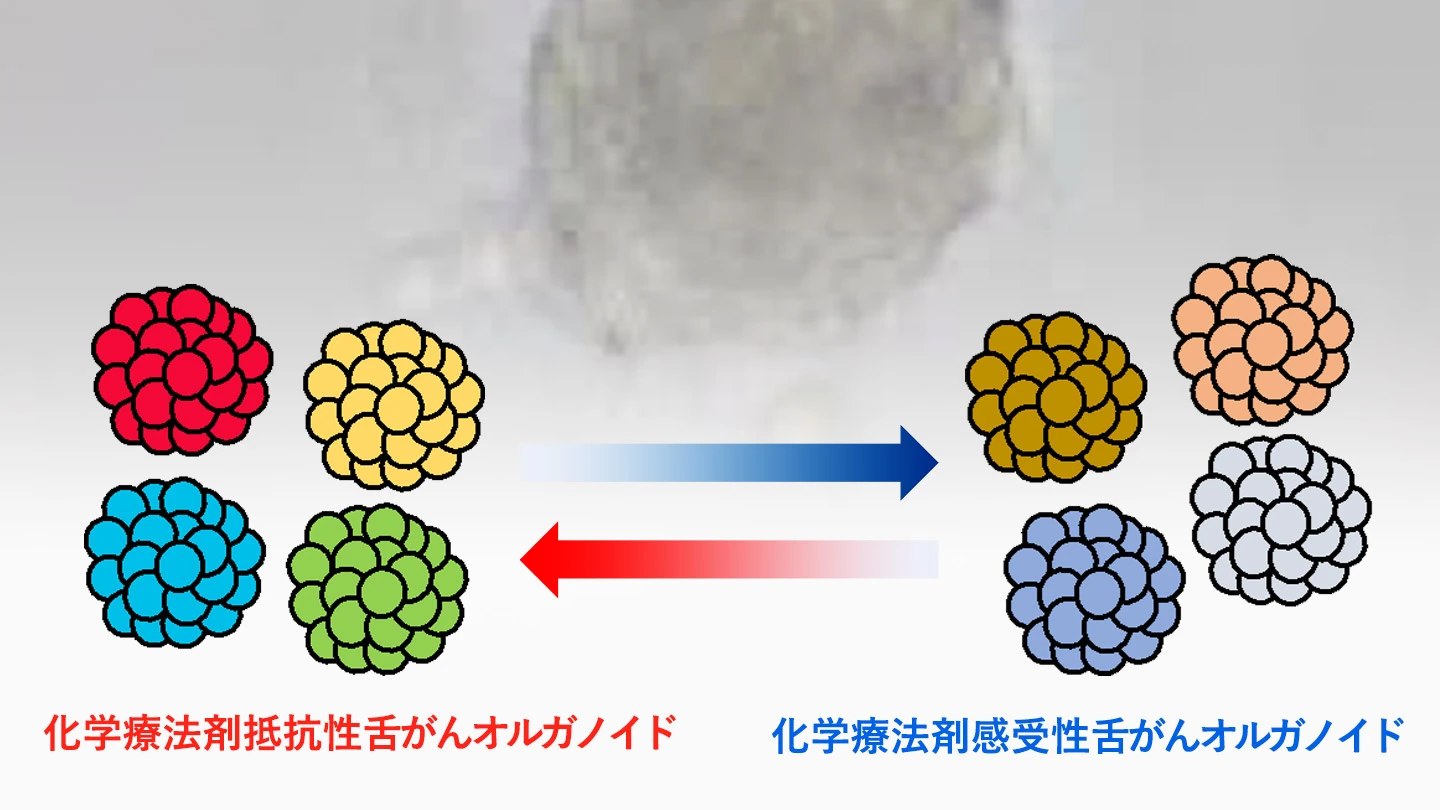 舌がんの再発メカニズムを解明、新たな治療法に道 | Science Tokyo
