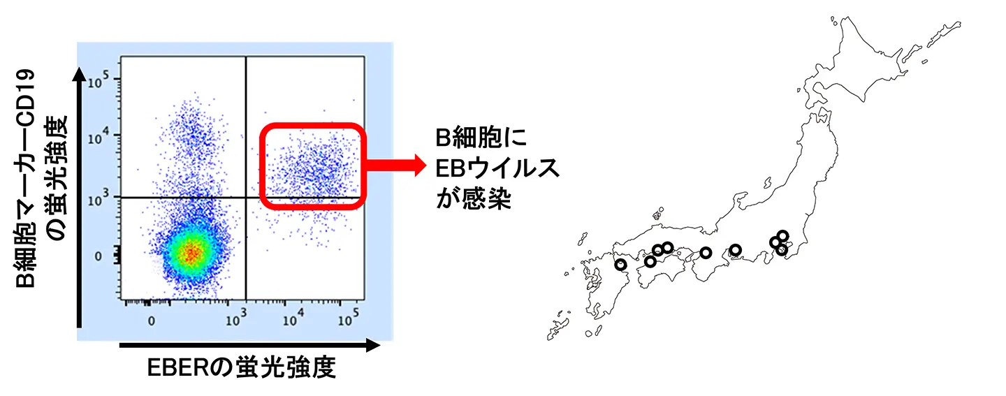 EBウイルス感染細胞を1細胞単位で特定する新技術『EBER flow FISH』を実用化