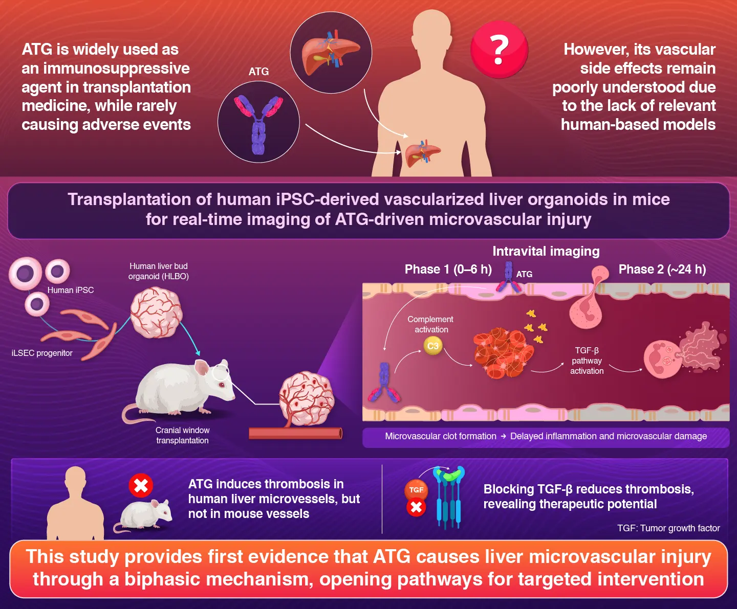 Modeling antithymocyte globulin-induced microvasculopathy using human iPSC-derived vascularized liver organoids