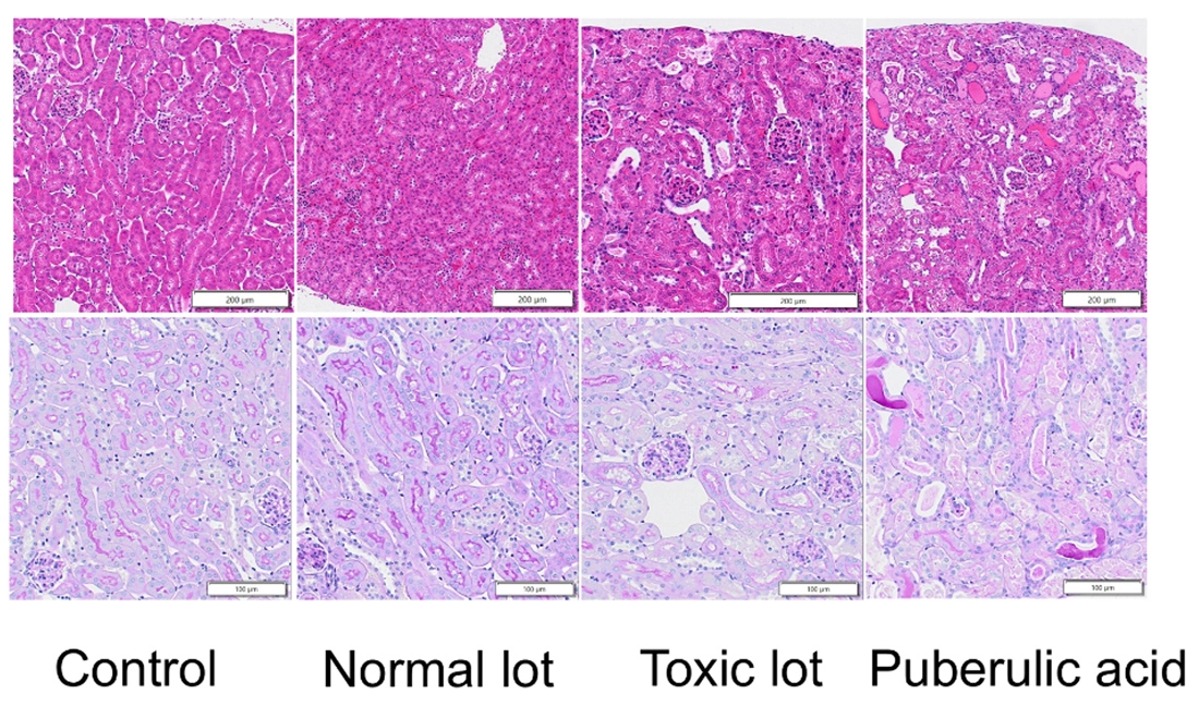 紅麹コレステヘルプ腎症の原因物質と発症機序を解明～プベルル酸が引き起こすミトコンドリア障害を分子レベルで実証～