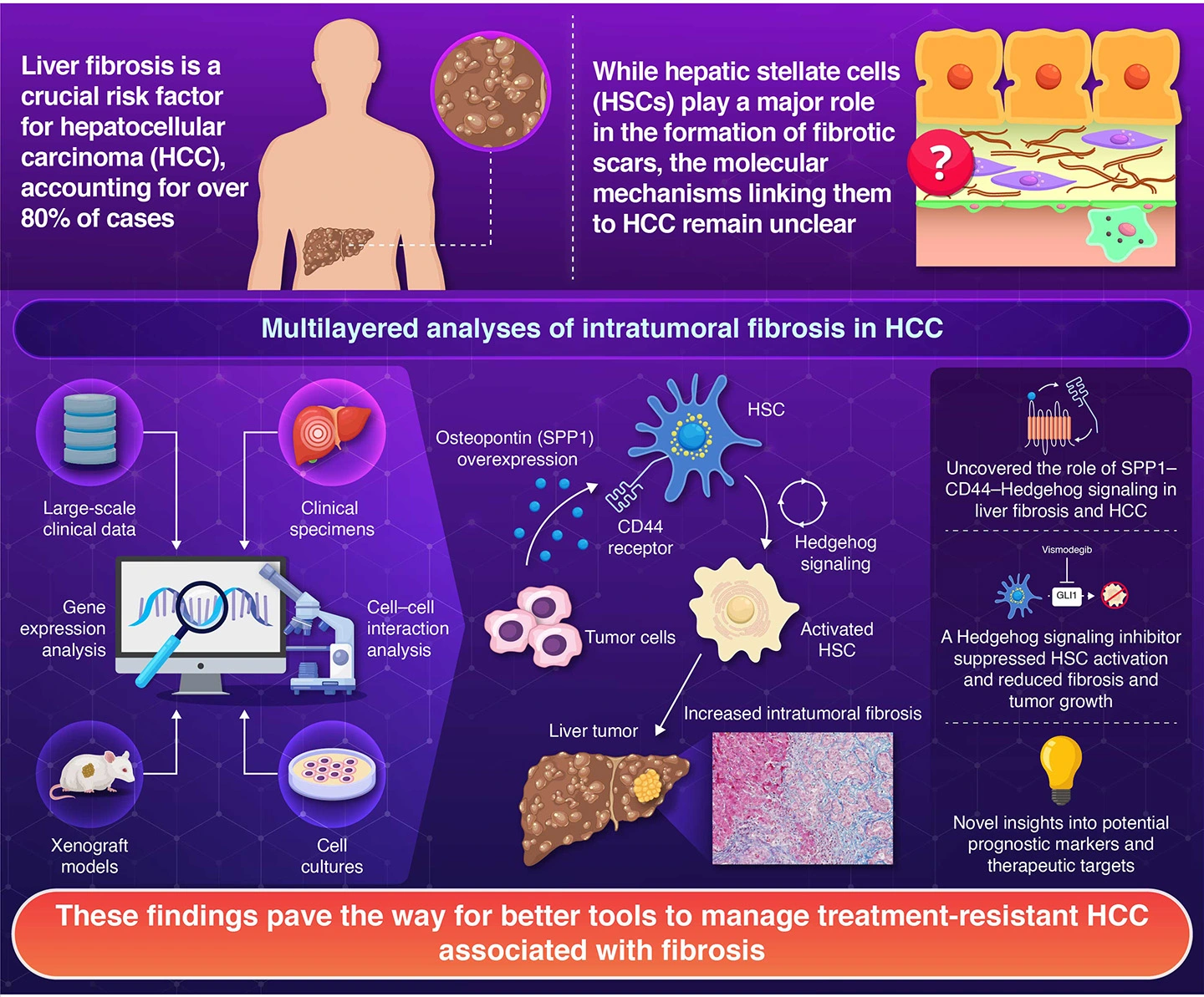 Targeting SPP1-CD44-Hedgehog Axis Elicits Therapeutic Effects in Hepatocellular Carcinoma by Suppressing Intratumoral Fibrosis
