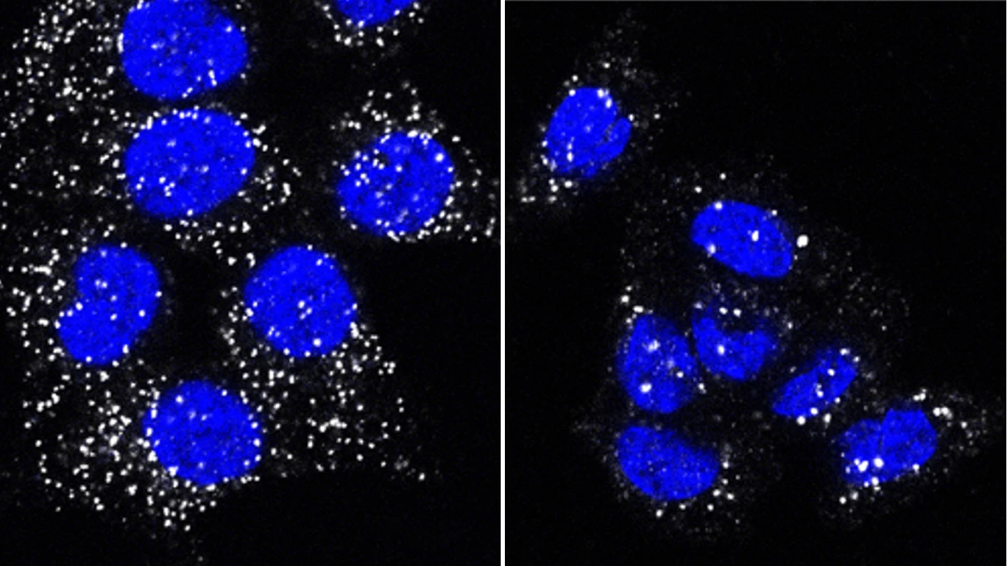 細胞の品質管理メカニズム：ペルオキシソーム分解を抑制する新たな