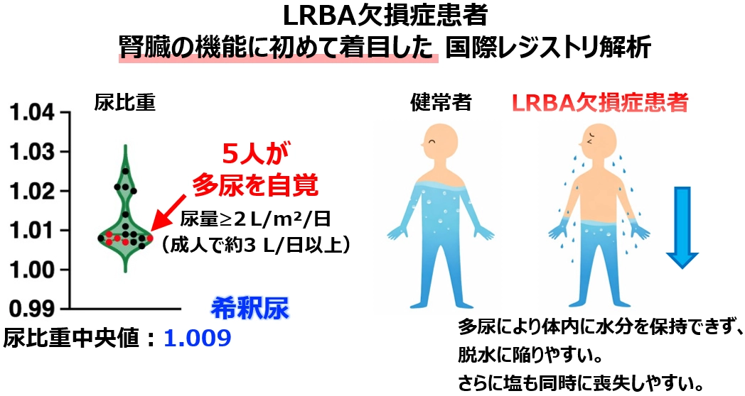 LRBAが⽔と塩を協調的に保持する仕組みを解明 ― LRBA⽋損症における多尿と電解質異常の分⼦基盤を解明 ―