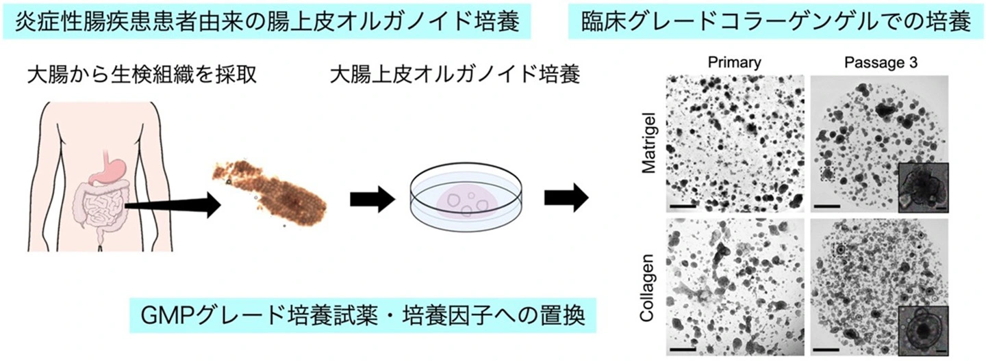 患者由来ヒト大腸上皮オルガノイドの 臨床グレード培養法を確立 －Wnt活性ペプチドにより高効率・高安定な培養を実現し、 消化管再生医療の実用化を加速－