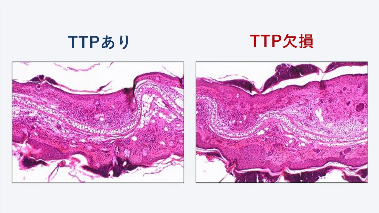 アレルギーの鍵を握るブレーキ役「TTP」は好塩基球の暴走を制御