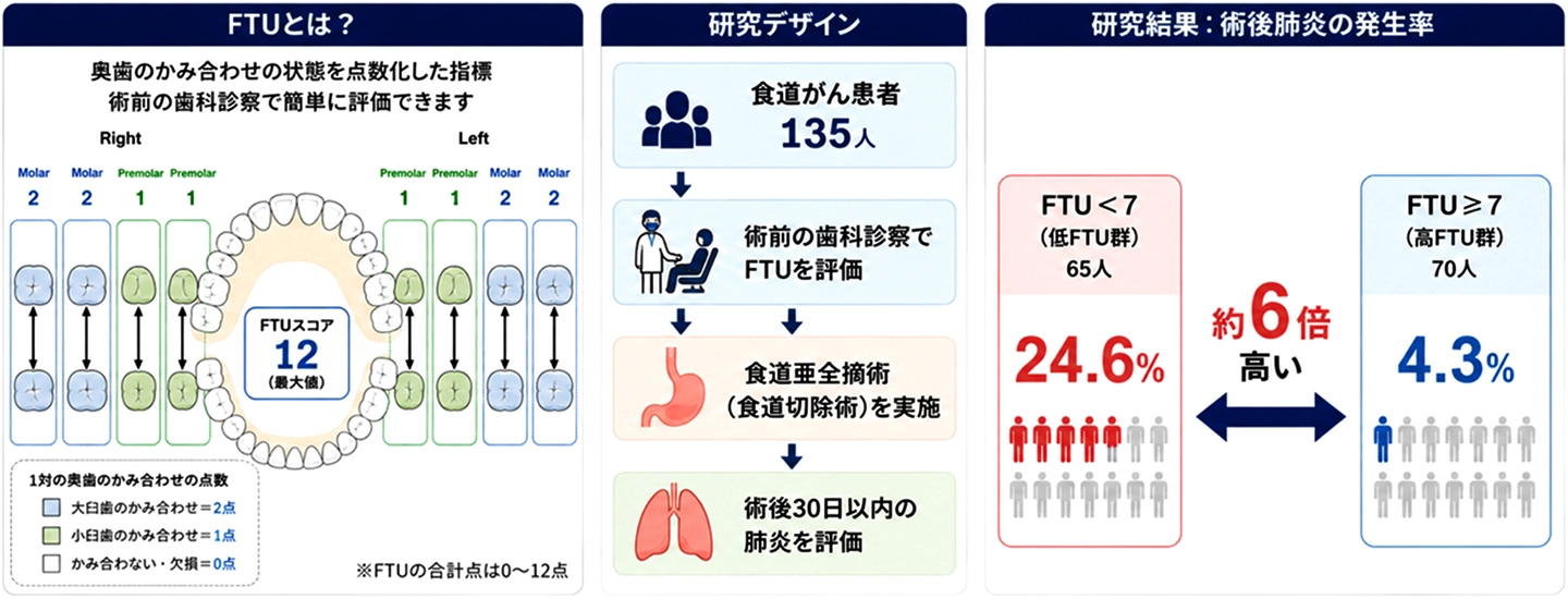 術前の奥歯のかみ合わせで食道がん手術後の肺炎リスクを予測 ー歯科診察で評価できるFTUが新たな周術期リスク評価指標となる可能性ー