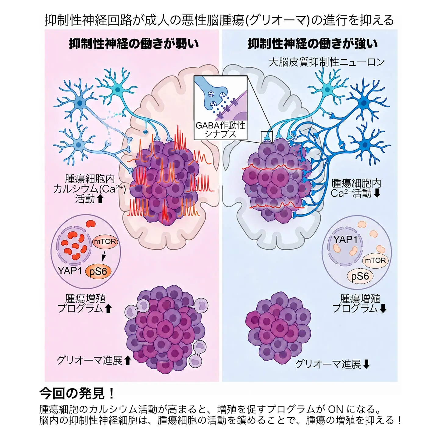 抑制性神経回路が成人の悪性脳腫瘍(グリオーマ)の進行を抑える。腫瘍細胞のカルシウム活動が高まると、増殖を促すプログラムがONになる。 脳内の抑制性神経細胞は、腫瘍細胞の活動を鎮めることで、腫瘍の増殖を抑える!