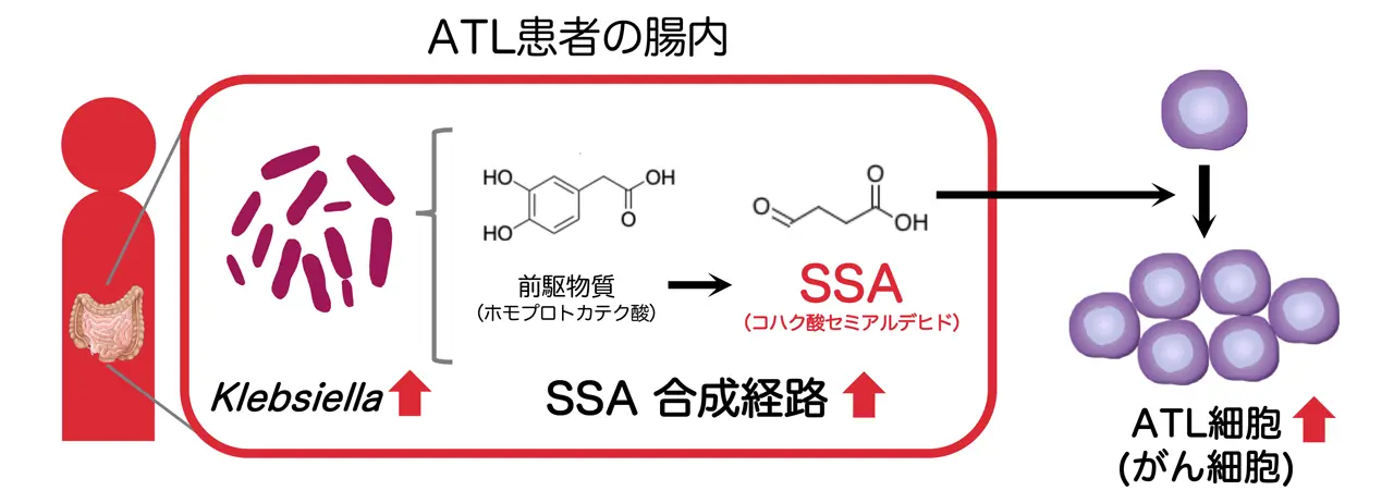 腸内細菌が生産できる代謝物質(SSA)はATL患者のがん細胞の増殖を促進する。