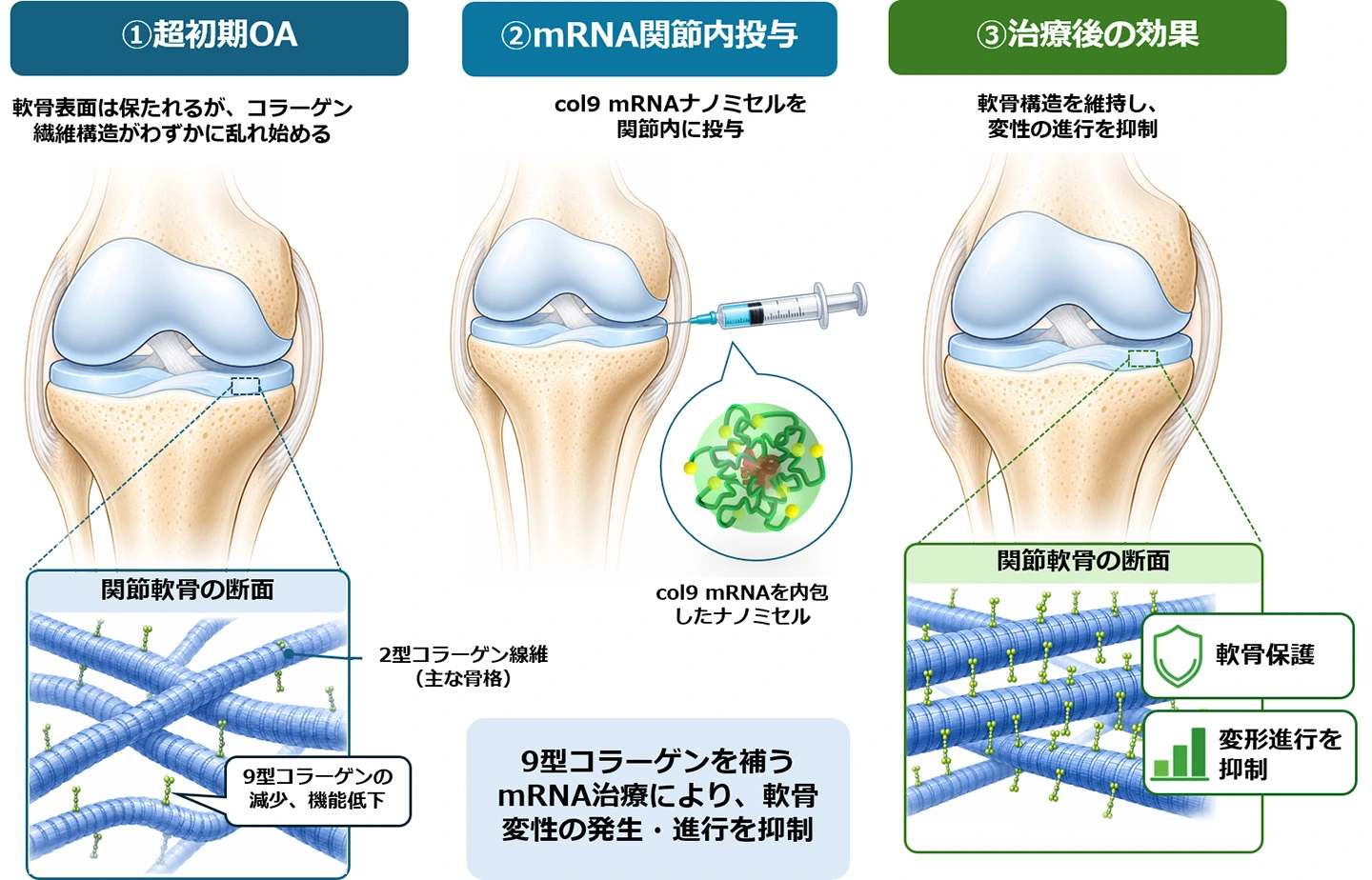 骨が壊れ始める“最初の一歩”をmRNAで食い止めるー「疾患を治療する」から「疾患を成立させない」変形性関節症治療へー を選択	 軟骨が壊れ始める“最初の一歩”をmRNAで食い止めるー「疾患を治療する」から「疾患を成立させない」変形性関節症治療へー