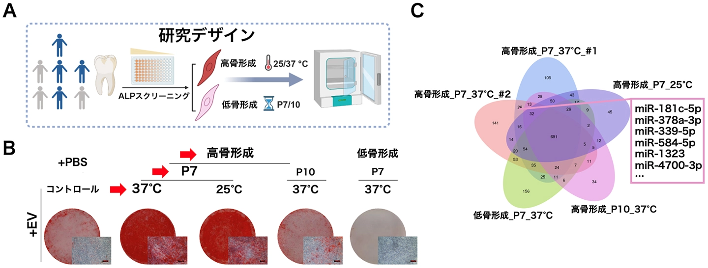 細胞外小胞が歯周組織の再生を調節する仕組みを解明ーmicroRNAによる幹細胞の運命制御を明らかに 歯周炎の新たな無細胞治療へー