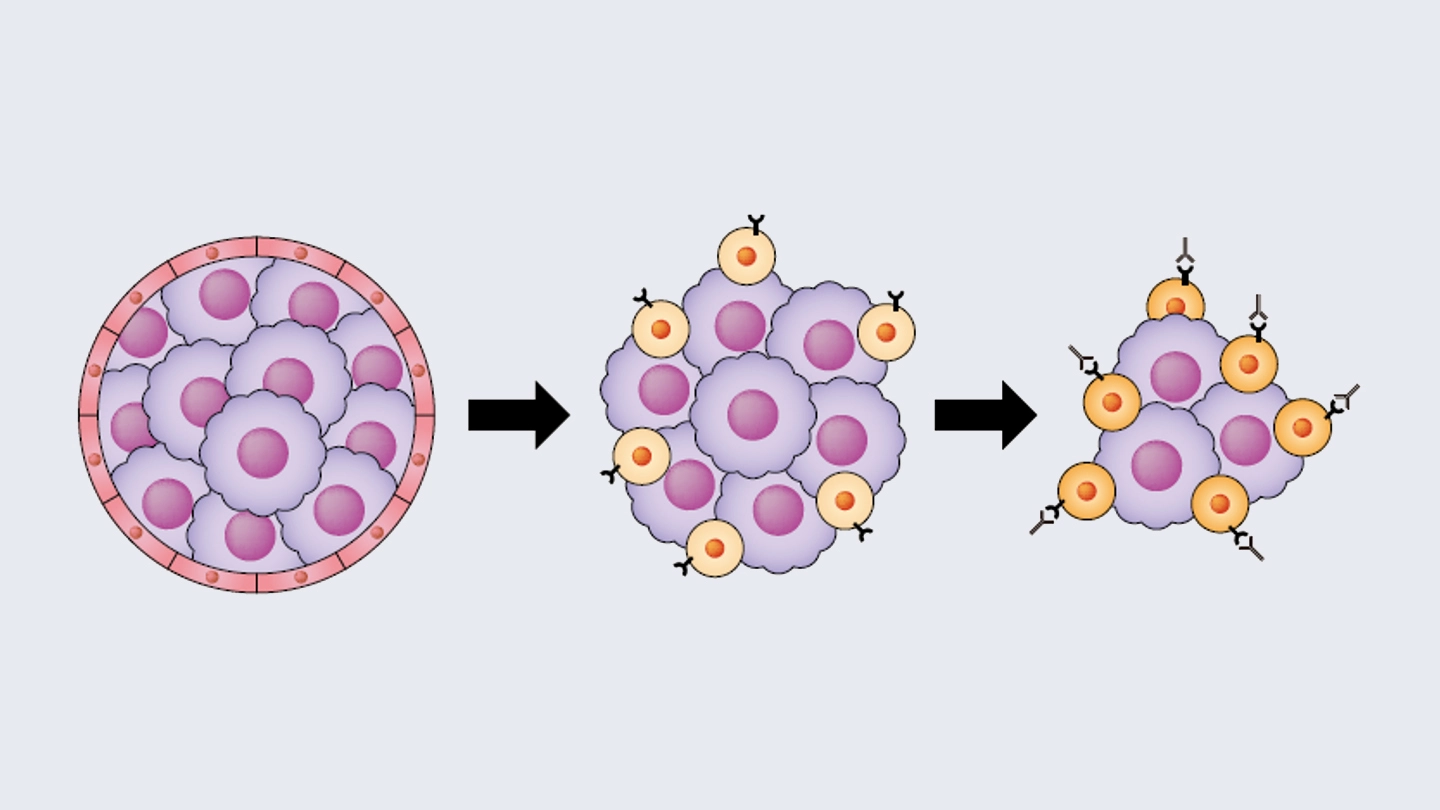 高悪性度肝がんの新たな治療戦略を提唱 | Science Tokyo - 東京科学大学