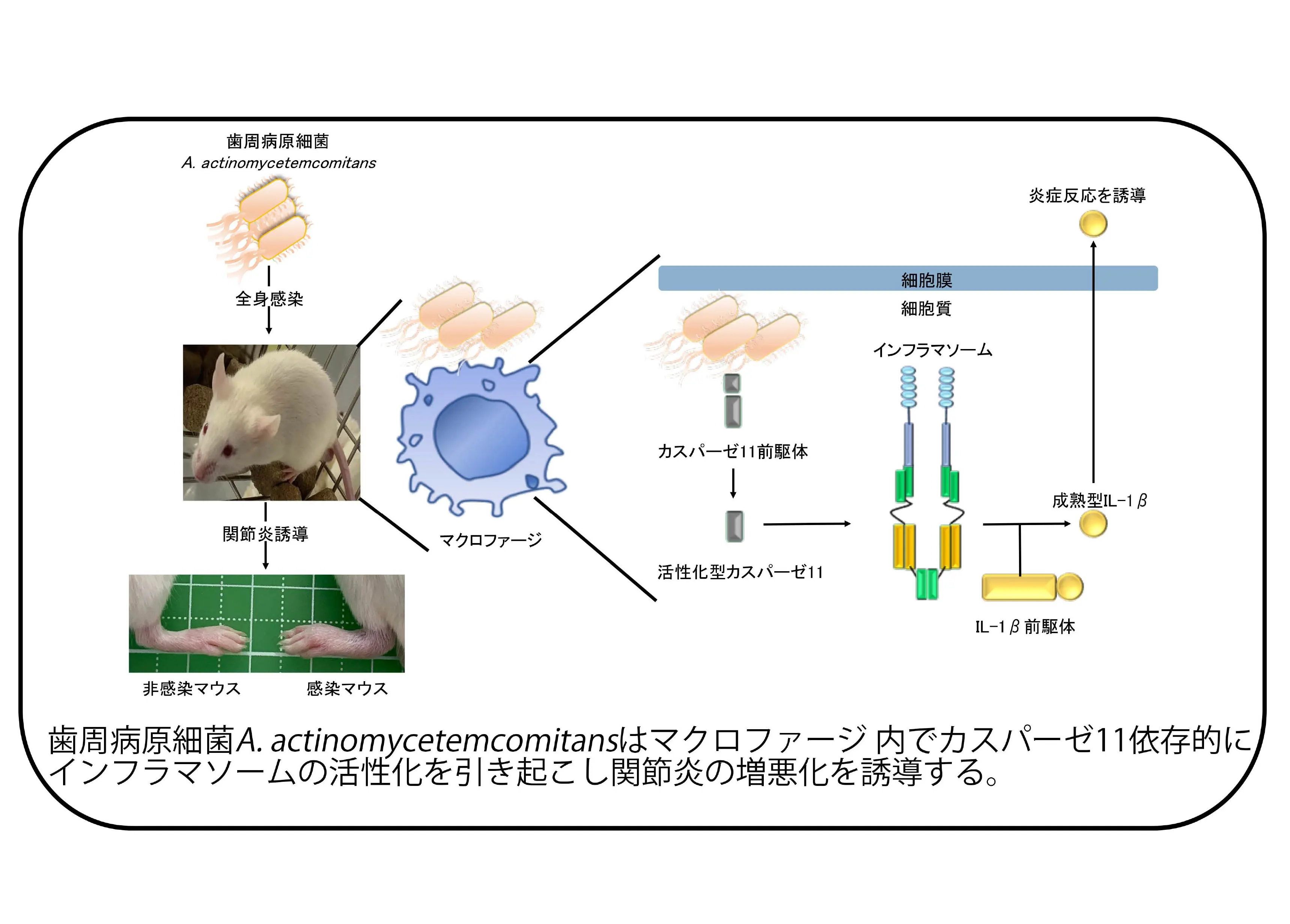 歯周病原細菌A.actinomycetemcomitansはマクロファージ内でカスパーゼ11依存的にインフラマソームの活性化を引き起こし関節炎の増悪化を誘導する